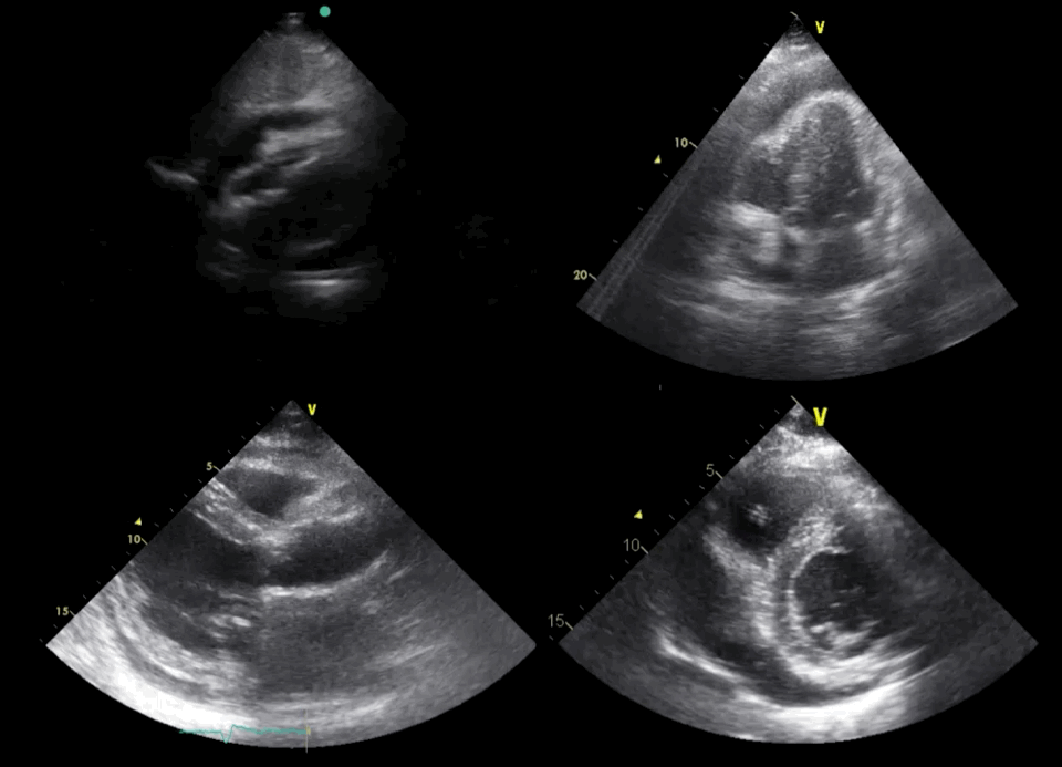 EEU case image missing